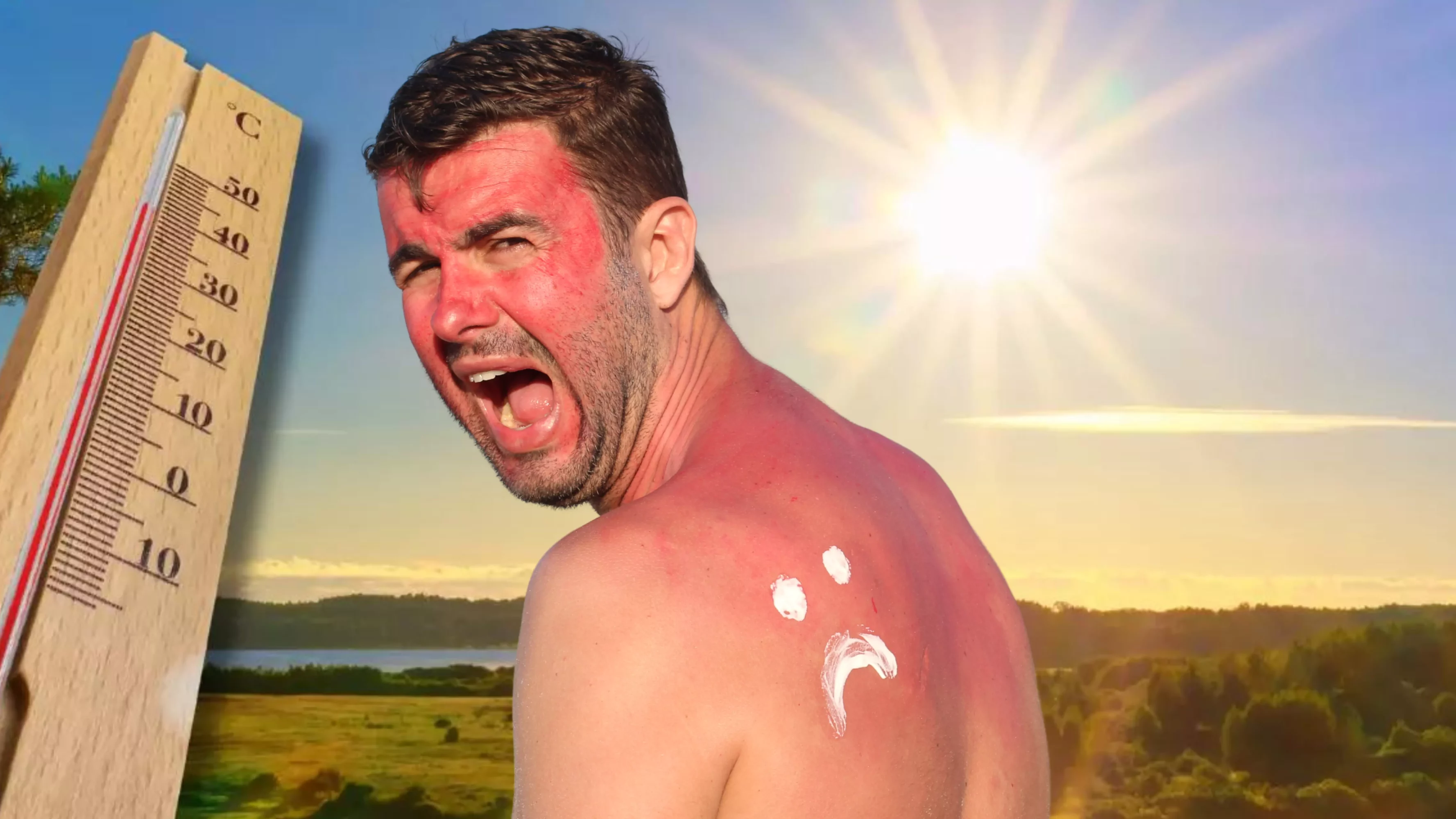 Das Bild auf 5min.at zeigt einen Mann mit Sonnenbrand.